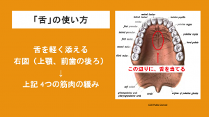 hard palate